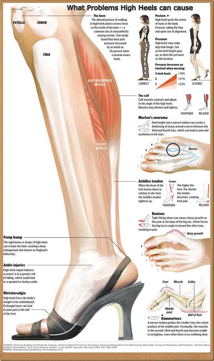 Name:  Feet aren't made for heels  .jpg
Views: 2759
Size:  129.9 KB
