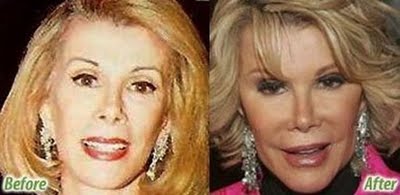 Name:  plastic-celebrities-11.jpg
Views: 1375
Size:  15.8 KB