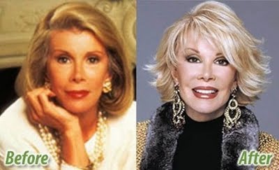 Name:  plastic-celebrities-16.jpg
Views: 1348
Size:  18.6 KB