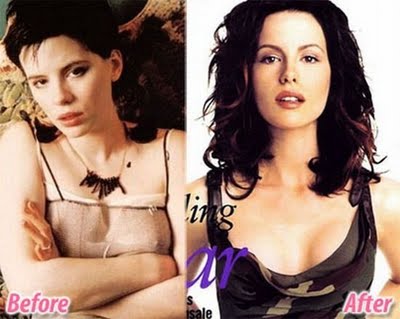 Name:  plastic-celebrities-24.jpg
Views: 1283
Size:  24.4 KB