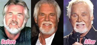 Name:  plastic-celebrities-26.jpg
Views: 1790
Size:  16.4 KB