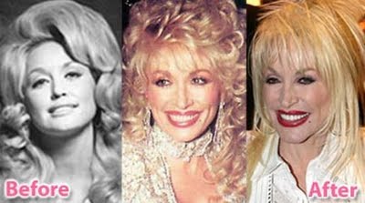 Name:  plastic-celebrities-29.jpg
Views: 1321
Size:  18.8 KB