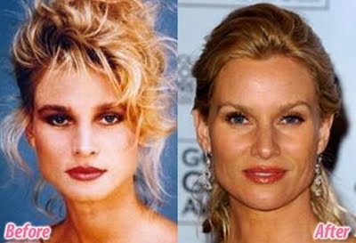 Name:  plastic-celebrities-30.jpg
Views: 1338
Size:  19.6 KB