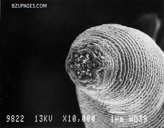 Name:  devil-worm-nematode-found-in-mine.jpg
Views: 1000
Size:  54.5 KB