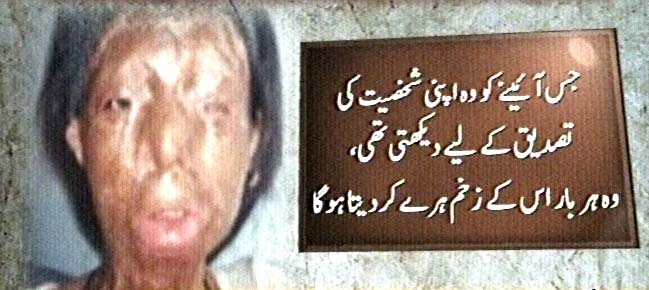 Name:  Acid attack victim Fakhra Younus commits suicide after 12 years (3).jpg
Views: 9721
Size:  53.9 KB