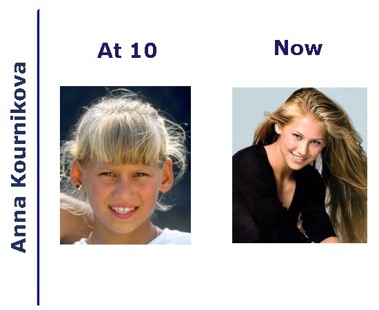 Name:  now and then Anna Kournikova.jpg
Views: 2815
Size:  36.1 KB