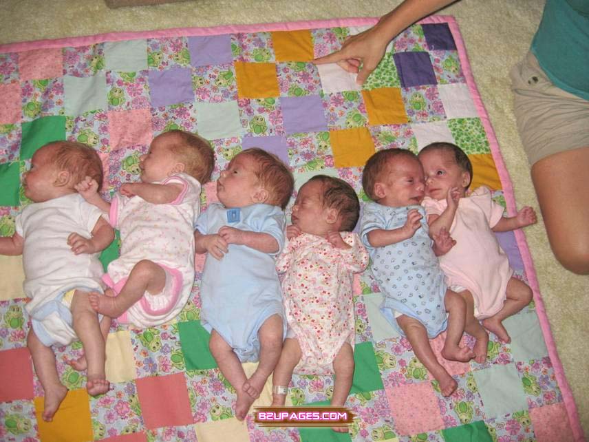Name:  Birth of Six Kids At Once (7).jpg
Views: 2308
Size:  104.1 KB