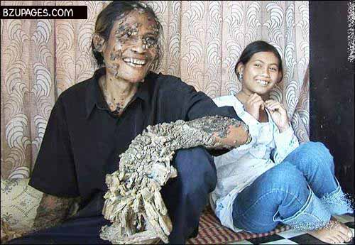 Tree Man2