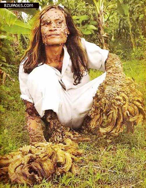 Tree Man